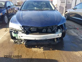 2015 Acura TLX Advance with VIN 19UUB3F74FA009984, listed as a IAAI auction lot 41724728 with 155,841 mi miles and . Bid and sale history available at DreamBid. Image 6.