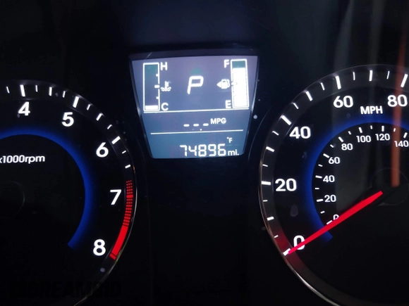 2017 Hyundai Accent SE with VIN KMHCT4AE7HU308112, listed as a IAAI auction lot 41481047 with 74,896 mi miles and . Bid and sale history available at carsss.com. Image 7.
