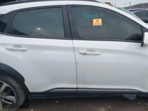 2021 Hyundai Kona Ultimate with VIN KM8K5CA58MU721649, listed as a IAAI auction lot 41215632 with 1 mi miles. Bid and sale history available at carsss.com. Image 14.