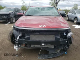 2024 Hyundai Kona SE с VIN KM8HACAB5RU118922, выставлен на аукционе Copart как лот 57245735 с пробегом 15 079 миль миль и На запчасти • Non repairable. История ставок и продаж доступна на DreamBid. Изображение 5.