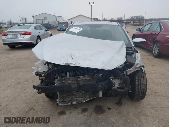 2017 Hyundai Elantra SE z VIN 5NPD84LF1HH166995, wystawiony jako IAAI lot #41511180 z przebiegiem 76 739 mil mil oraz . Historia ofert i sprzedaży dostępna na DreamBid. Obrazek 12.