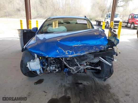 2017 Hyundai Elantra SE with VIN KMHD74LF5HU095093, listed as a IAAI auction lot 41957451 with 75,760 mi miles. Bid and sale history available at carsss.com. Image 13.